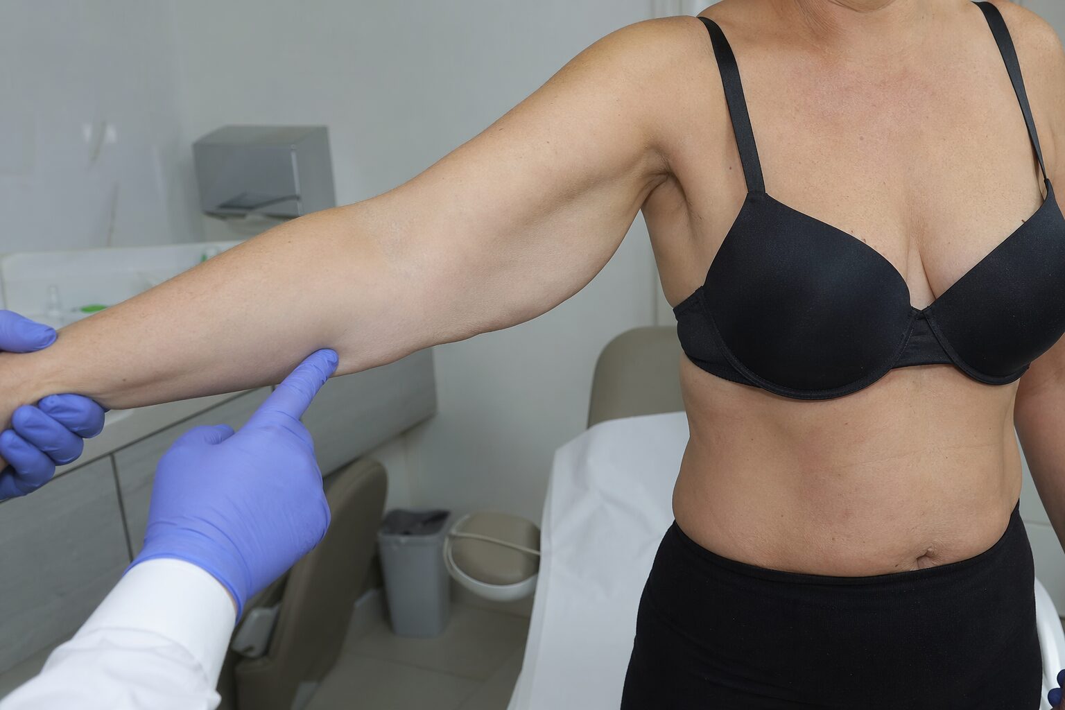 Braquioplastia - imagen ilustrativa del procedimiento